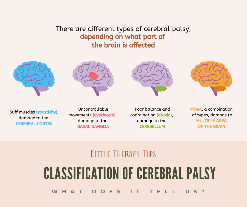 CLASSIFICATION OF CEREBRAL PALSY What Does It Tell Us Little 